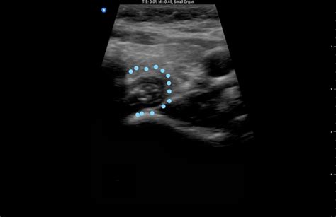 Anatomy Ultrasound Views My Endo Consult