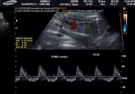 Bienestar Fetal Medicina Fetal Avanzada