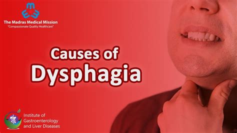 Causes Of Dysphagia Youtube
