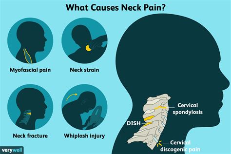 목 경부 통증 중추신경과 근골격계를 한번에 볼수 있는 곳 네이버 블로그