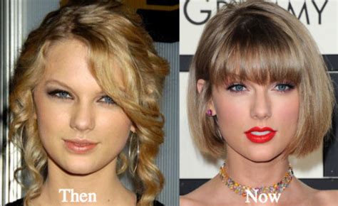 Taylor Swift Plastic Surgery Before And After Photos