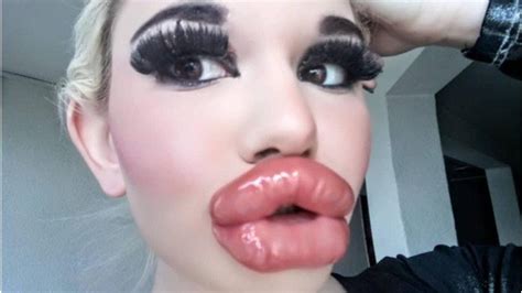 Andrea Ivanova Goes Viral After Receiving 20 Lip Injections Real Life Barbie Wants The Worlds