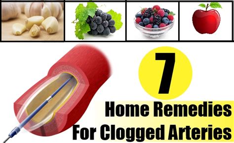 7 Home Remedies For Clogged Arteries Natural Home Remedies And Supplements