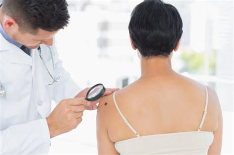 skin cancer signs self checks may help you avoid deadly recurrence university health news