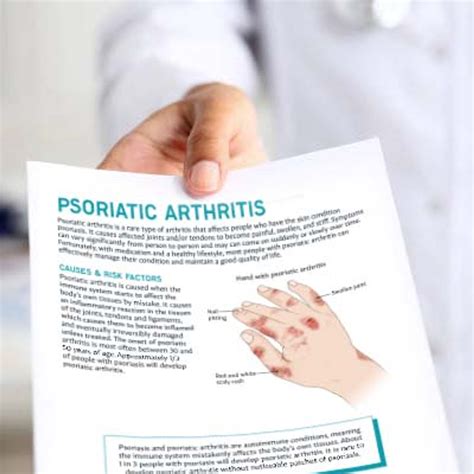 Psoriatic Arthritis Patient Education Handout Peripheral Neuropathy