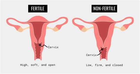 Why Your Menstrual Cup Is Leaking The Fornix Flex