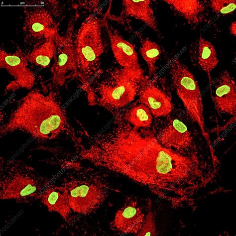 Mesenchymal Stem Cells Fluorescence Light Micrograph Stock Image