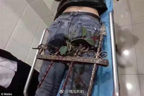 Chinese Man Impaled By Two Steel Rods In The Buttocks Daily Mail Online