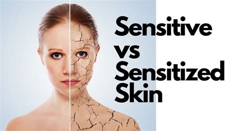 Sensitive Vs Sensitized Skin Youtube