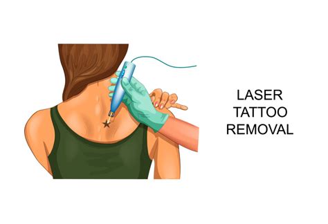 If so, picosure treatment may be right for you. Is Tattoo Removal Permanent to Help Me Get Rid of Unwanted ...