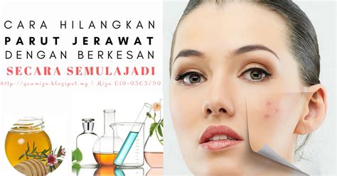 Maybe you would like to learn more about one of these? Cara Hilangkan Parut Jerawat Yang Berkesan Secara Natural ...