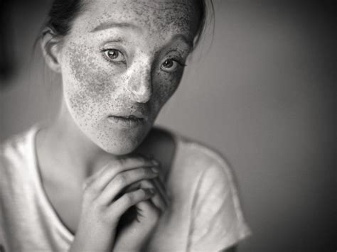 26 Year Old Born With Extremely Rare Facial Condition Is Now A Model And Shes Breaking Beauty