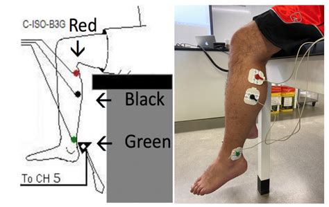 Assessment Of Patellar And Achilles Reflexes A Mixed Course Based