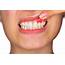 Home Remedies Against Inflamed Gums 5 Practical Tips  Womens Alphabet