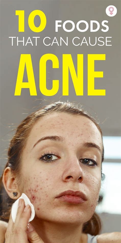 Top 10 Foods That Can Cause Acne What To Eat For Clear Skin Artofit