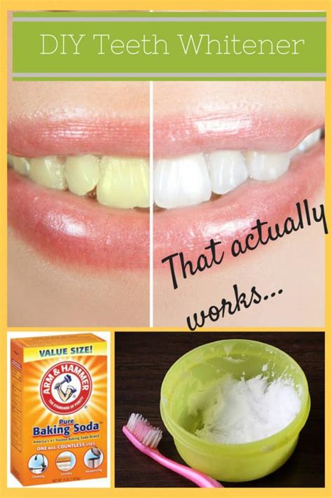 Teeth Whitening Hacks At Home