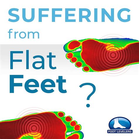Its All About Your Feet Flat Feet I Bet You Have Them