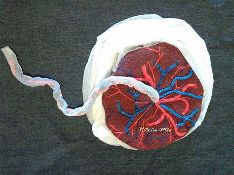 Placenta Cara Fetal Con Su Cordón Umbilical Y Vasos Sanguíneos