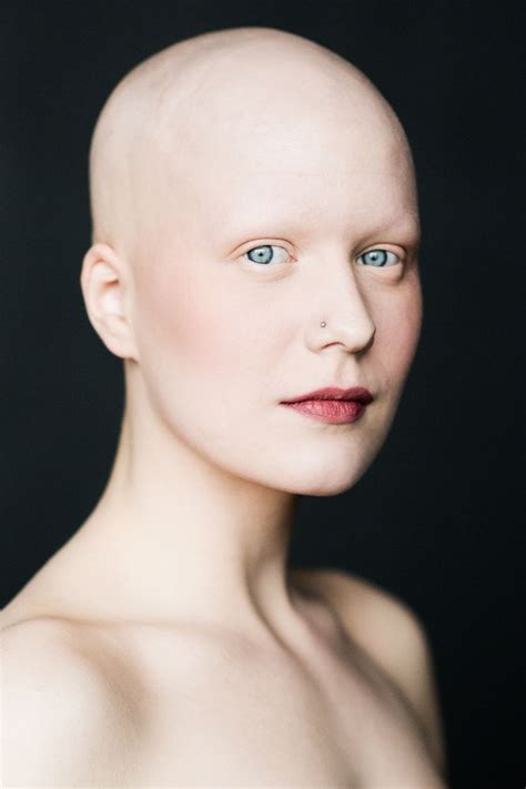 Stunning Portraits Of Women With Alopecia Redefine Femininity Bald Women Bald Head Women