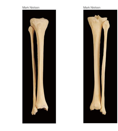 Figure 109 Right Tibia Fibula And Patella Real Bones Diagram Quizlet