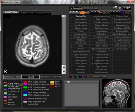 Ct And Mri Interactive Atlas Of Cross Sectional Anatomy Download And Review