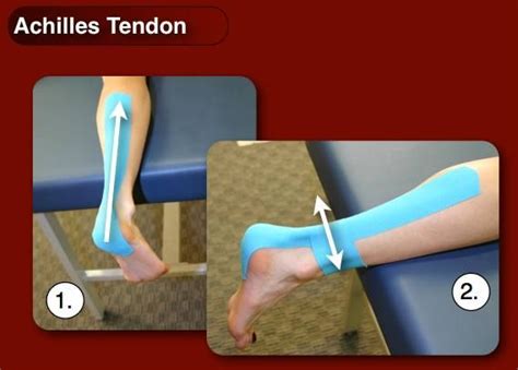 Kinesiology Taping The Achilles Tendon And Calf Rocktape Canada