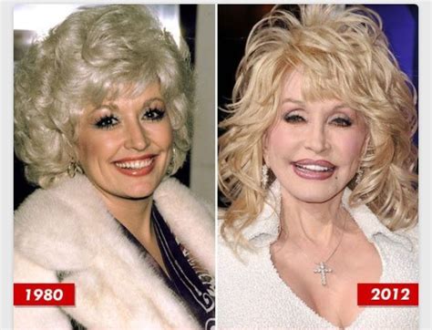 Dolly Parton then and now | Dolly parton, Celebrities ...