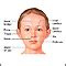 Because the traditional surgical methods carry the risk of anesthesia, bleeding, infections, fibrosis and its use for simultaneous correction of medial epicanthal folds and flat. health fitness medical: June 2010
