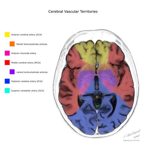 Cerebral Vascular Anatomy Headache Treatments