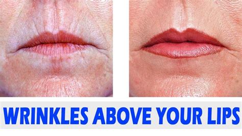 how to get rid of wrinkles above your lips natural remedies for wrinkl how to line lips
