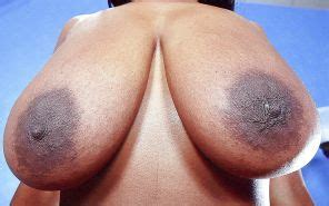 Huge Juicy Nipples Pancake Sized Areolas Porn Pictures Xxx Photos