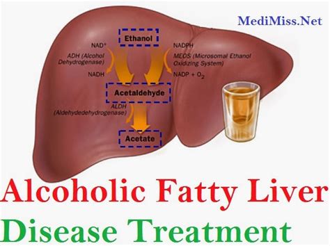 Alcoholic Fatty Liver Disease Treatment Skinnyzine