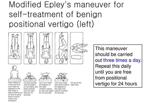 Modified Epley Maneuver Handout Spanish Epley Maneuver Instructions