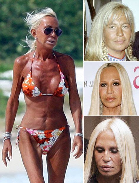 Pin By Shannon Fraser On Ha Ha In Donatella Versace Plastic Surgery Plastic Surgery