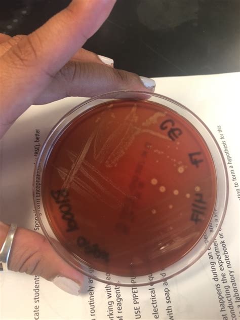 Solved Help Identify Unknown Bacteria Through Biochemical