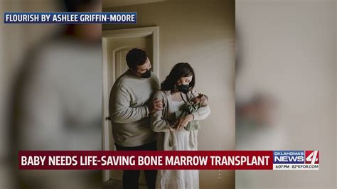 Baby Needs Life Saving Bone Marrow Transplant Youtube