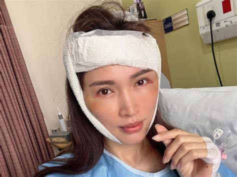 Supermodel Amber Chia To Seek Neurological Care After Being Hospitalised For A ‘blackout Fall