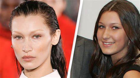 Bella Hadid Admits To Having Plastic Surgery Aged 14 After Feeling Like