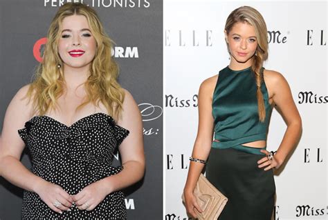 Did These Stars Undergo Gastric Bypass Surgery See Their Shocking