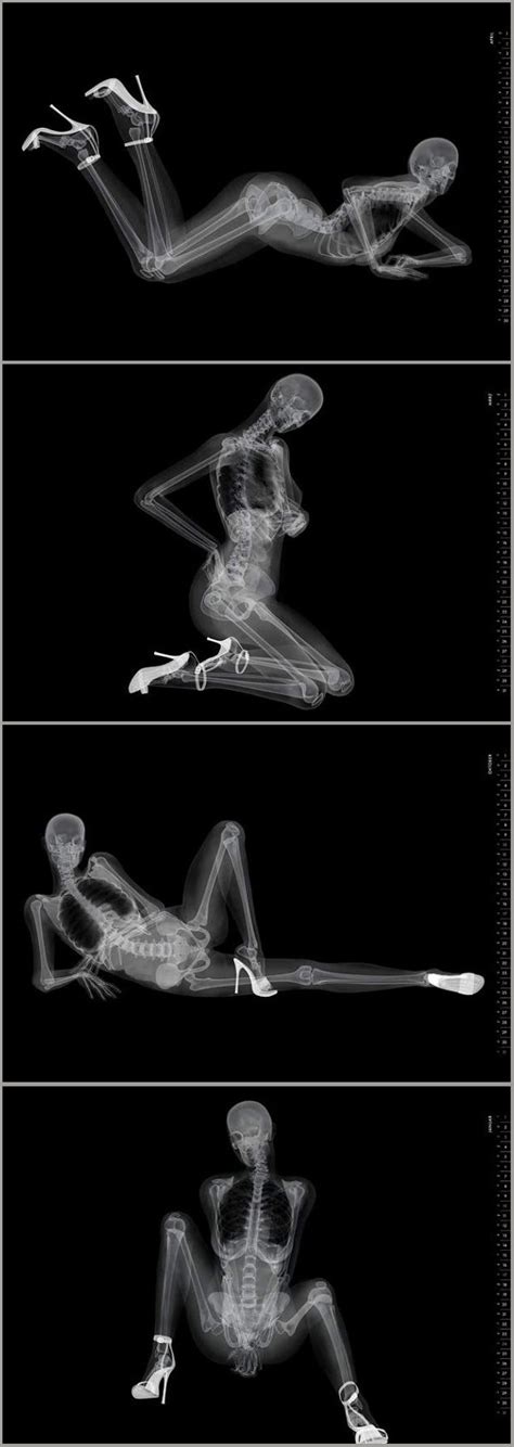 Nude X Rays Anatomy Reference Radiology Skull And Bones X Ray Photo