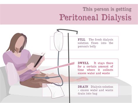 Peritoneal Dialysis Gaytri Manek Formerly Gandotra Md