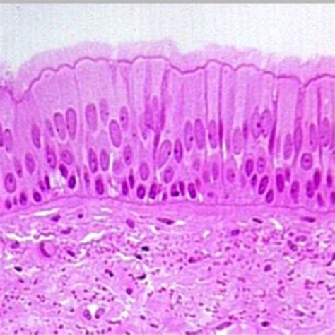 El epitelio cilíndrico pseudoestratificado se caracteriza por tener células más altas que anchas