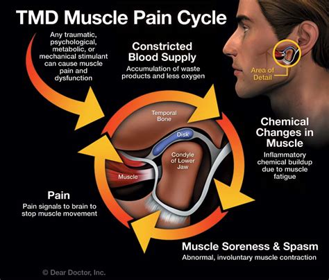 Tmj Disorders Causes Signs And Symptoms Treatment Options Derby
