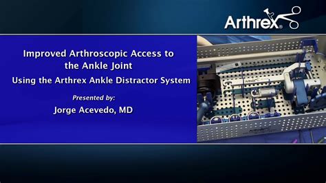 Arthrex Improved Arthroscopic Access To The Ankle Joint Using The