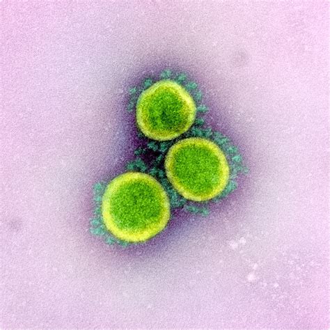 Pre Covid 19 Coronavirus Immunity Does Not Protect Against Sars Cov 2