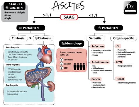 Image 7 Ascites Schema The Clinical Problem Solvers