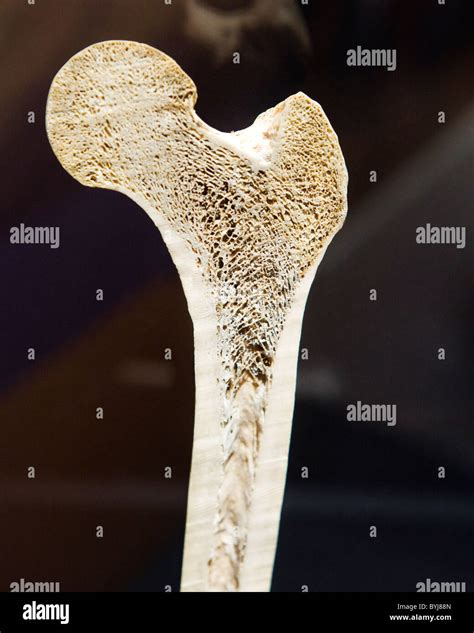 Cross Section View Of A Human Femur Bone Showing Trabecula Stock Photo