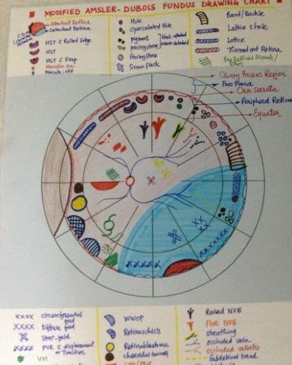 Amsler Dubois Retinal Chart For Depicting Various Lesions In The Case