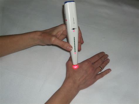 Laserakupunktur Buchholz Für Erwachsene Und Kinder