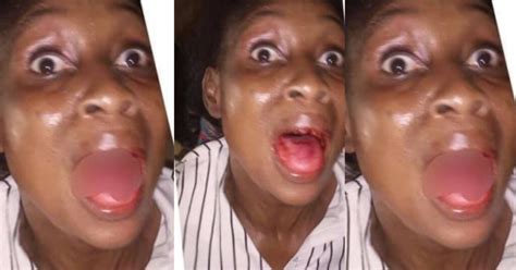 Lady Begs Court To Release Abusive Husband After She Lost Her Front Teeth Through A Blow From